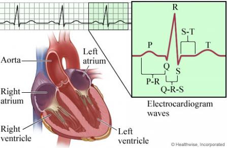 Heart rhythm diagram