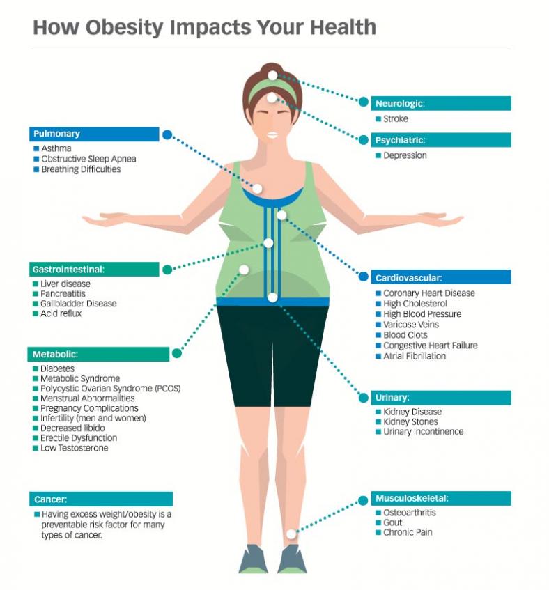Illustration showing how obesity impacts your health