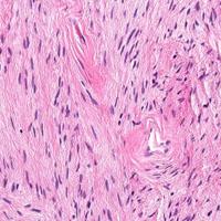 Bone and Soft Tissue Pathology sample 3