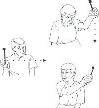 Visuo-vestibular exercise illustration