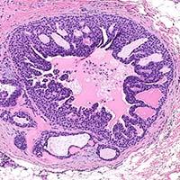 Dermatopathology Sample 2