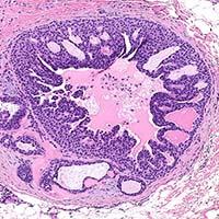 Dermatopathology Sample 2