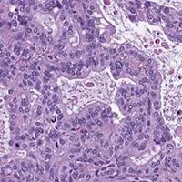 Thoracic, Head, and Neck Pathology Sample 1