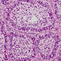 Thoracic, Head, and Neck Pathology Sample 2