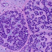 Thoracic, Head, and Neck Pathology Sample 3