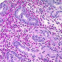 Pediatric and Perinatal Pathology Sample 3