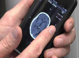 Doctor reviews brain scan on phone