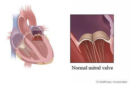 Mitral valve diagram