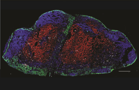 lymph node T cells