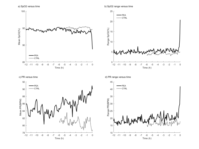 Pulseless electrical activity graphic